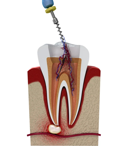 mediDental care | Ceramic Crowns, Dental Bridges and Implant Dentistry