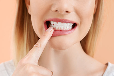 mediDental care | Veneers, Invisalign reg and Emergency Treatment